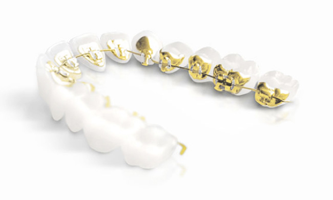 Cabinet d'orthodontie des drs. Aurélie Pic et Julien Mailly à Lens