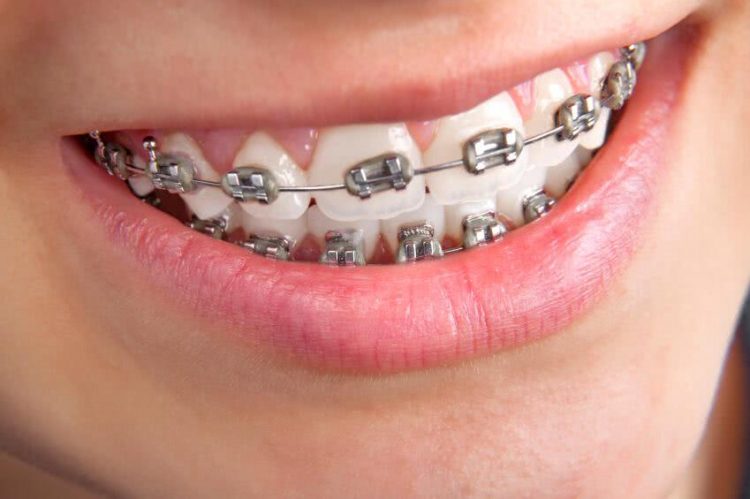 Cabinet d'orthodontie des drs. Aurélie Pic et Julien Mailly à Lens